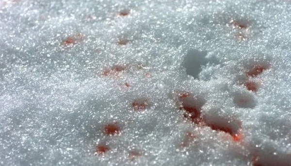 Снимал видео для тик-тока и попал в больницу. В Беларуси 10-летний мальчик прыгнул в сугроб — там оказалось стекло оконной рамы Снимал видео для тик-тока и попал в больницу. В Беларуси 10-летний мальчик прыгнул в сугроб — там оказалось стекло оконной рамы