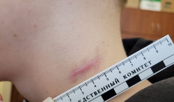 Мужчина чуть не убил двух парней из-за громкой музыки во дворе Мужчина чуть не убил двух парней из-за громкой музыки во дворе