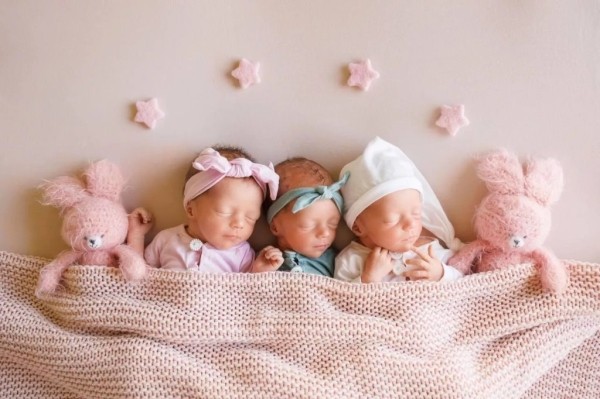 Один случай на 200 миллионов беременностей: гомельчанка родила трех близняшек