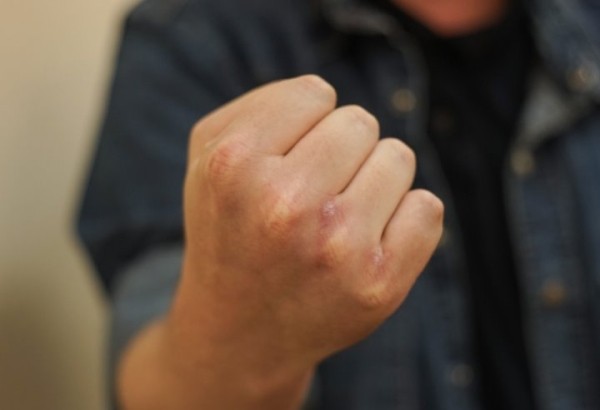 Житель Барановичей успокаивал дебошира, но перестарался, получил судимость и огромный штраф