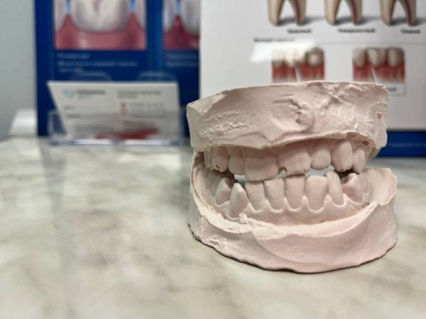 Потратил на зубы $15 тысяч — это того стоило? Белорусы, которые решились на брекеты во взрослом возрасте